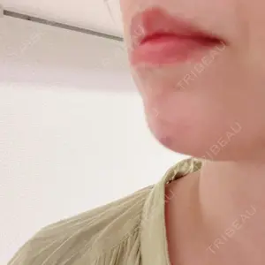 聖心美容クリニック グループ 聖心美容クリニック 六本木院口コミ