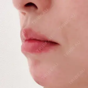 聖心美容クリニック グループ 聖心美容クリニック 六本木院口コミ