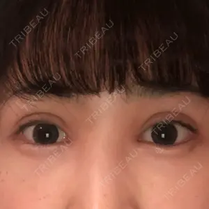 口コミ