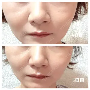 心斎橋形成外科スキンケアクリニック口コミ