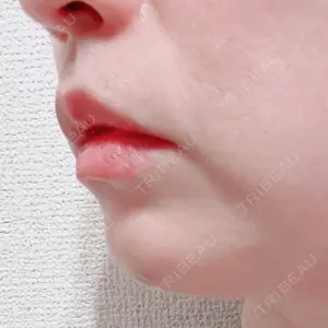 聖心美容クリニック グループ 聖心美容クリニック 六本木院口コミ