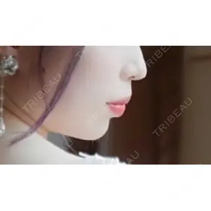 フィラークリニック フィラークリニック 名古屋栄院口コミ