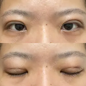 湘南美容クリニック 湘南美容クリニック 池袋東口院口コミ