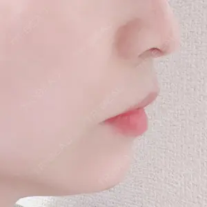 聖心美容クリニック グループ 聖心美容クリニック 六本木院口コミ