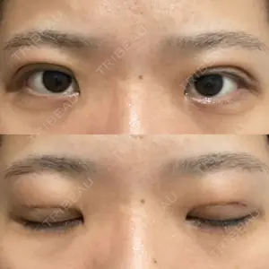 湘南美容クリニック 湘南美容クリニック 池袋東口院口コミ