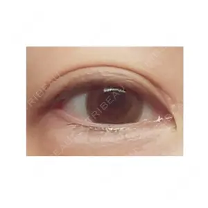 表参道スキンクリニック 表参道スキンクリニック 表参道院口コミ