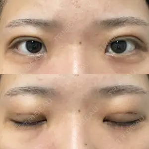 湘南美容クリニック 湘南美容クリニック 池袋東口院口コミ