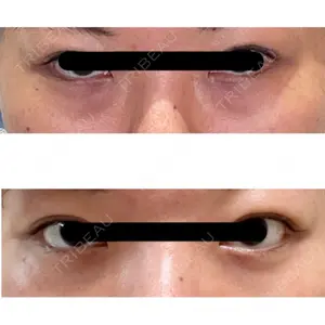APOLLO BEAUTY CLINIC口コミ