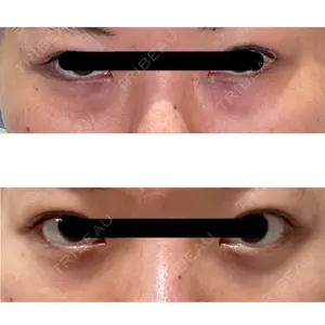 APOLLO BEAUTY CLINIC口コミ