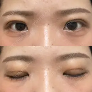 湘南美容クリニック 湘南美容クリニック 池袋東口院口コミ
