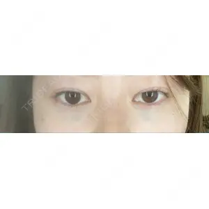 APOLLO BEAUTY CLINIC口コミ