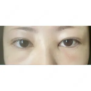 APOLLO BEAUTY CLINIC口コミ