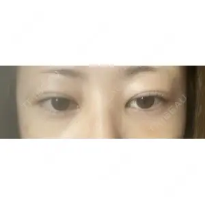 APOLLO BEAUTY CLINIC口コミ