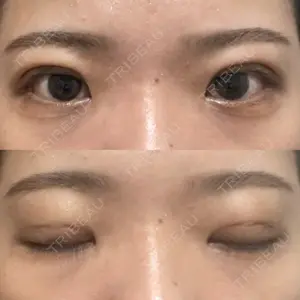 湘南美容クリニック 湘南美容クリニック 池袋東口院口コミ
