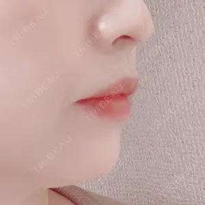 聖心美容クリニック グループ 聖心美容クリニック 六本木院口コミ