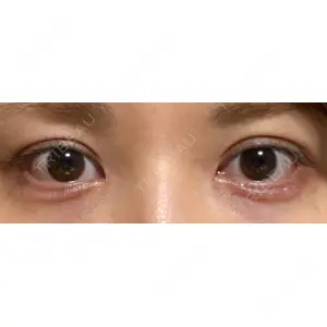 口コミ