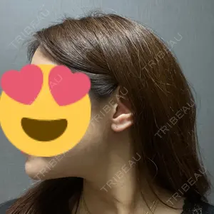口コミ
