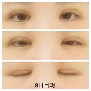 札幌ル・トロワ ビューティクリニックVogue口コミ