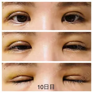 札幌ル・トロワ ビューティクリニックVogue口コミ