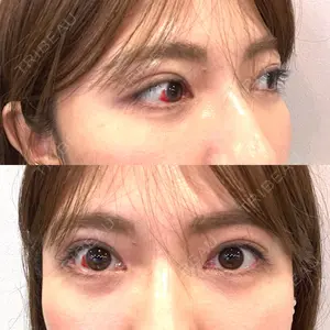 APOLLO BEAUTY CLINIC口コミ