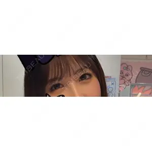 APOLLO BEAUTY CLINIC口コミ