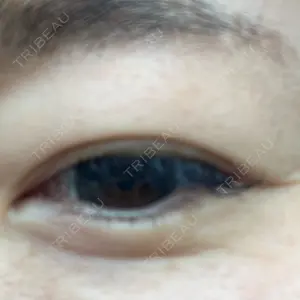TCB東京中央美容外科 TCB東京中央美容外科 銀座有楽町院口コミ