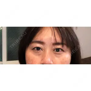 TCB東京中央美容外科 TCB東京中央美容外科 町田院口コミ