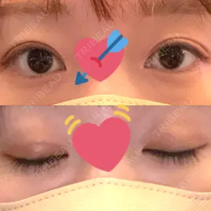 口コミ
