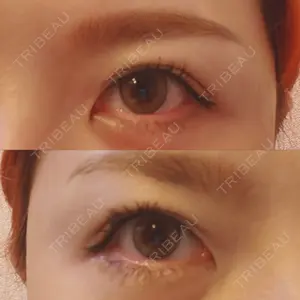 TCB東京中央美容外科 TCB東京中央美容外科 心斎橋筋院口コミ