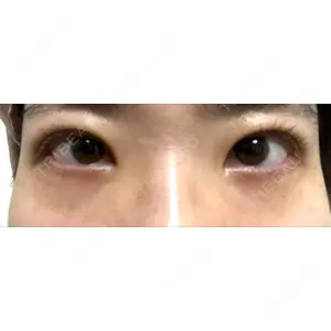 東京イセアクリニック口コミ
