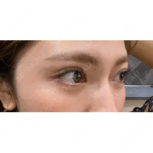 APOLLO BEAUTY CLINIC口コミ
