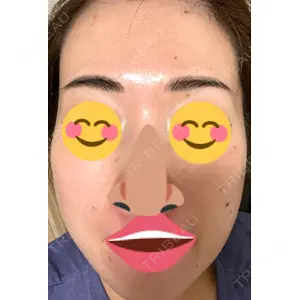 南青山TOKUNAKAクリニック口コミ