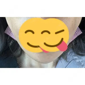TCB東京中央美容外科 TCB東京中央美容外科 郡山院口コミ