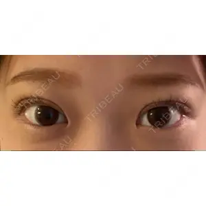 湘南美容クリニック 湘南美容クリニック 池袋東口院口コミ