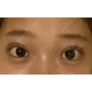 湘南美容クリニック 湘南美容クリニック 池袋東口院口コミ
