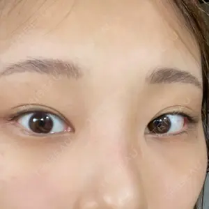 APOLLO BEAUTY CLINIC口コミ