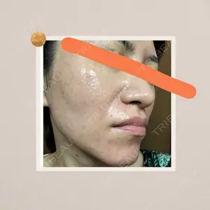 Rinato Beauty Clinic口コミ