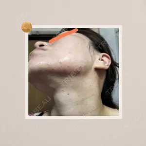 Rinato Beauty Clinic口コミ