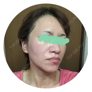 Rinato Beauty Clinic口コミ