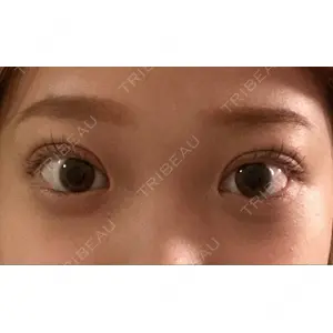 湘南美容クリニック 湘南美容クリニック 池袋東口院口コミ
