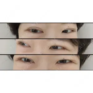 東郷美容形成外科 福岡口コミ