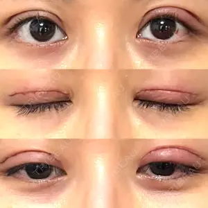 口コミ