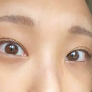 APOLLO BEAUTY CLINIC口コミ