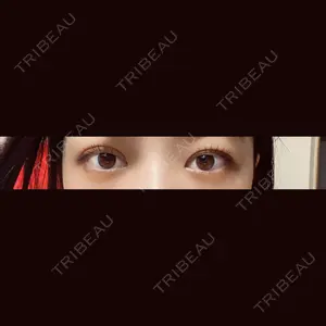 TCB東京中央美容外科 TCB東京中央美容外科 渋谷東口院口コミ