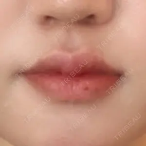 フィラークリニック フィラークリニック 町田院口コミ