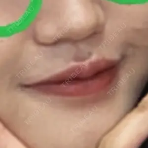 フィラークリニック フィラークリニック 町田院口コミ