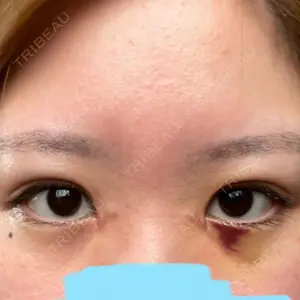 VENUS BEAUTY CLINIC　銀座院口コミ