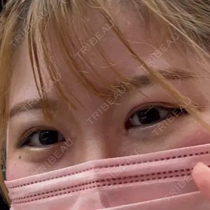 VENUS BEAUTY CLINIC　銀座院口コミ