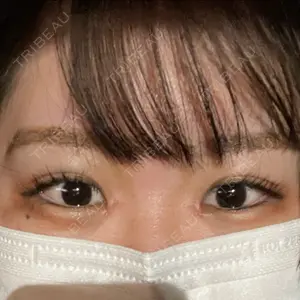 VENUS BEAUTY CLINIC　銀座院口コミ