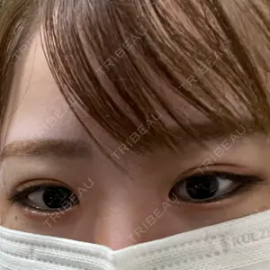 VENUS BEAUTY CLINIC　銀座院口コミ